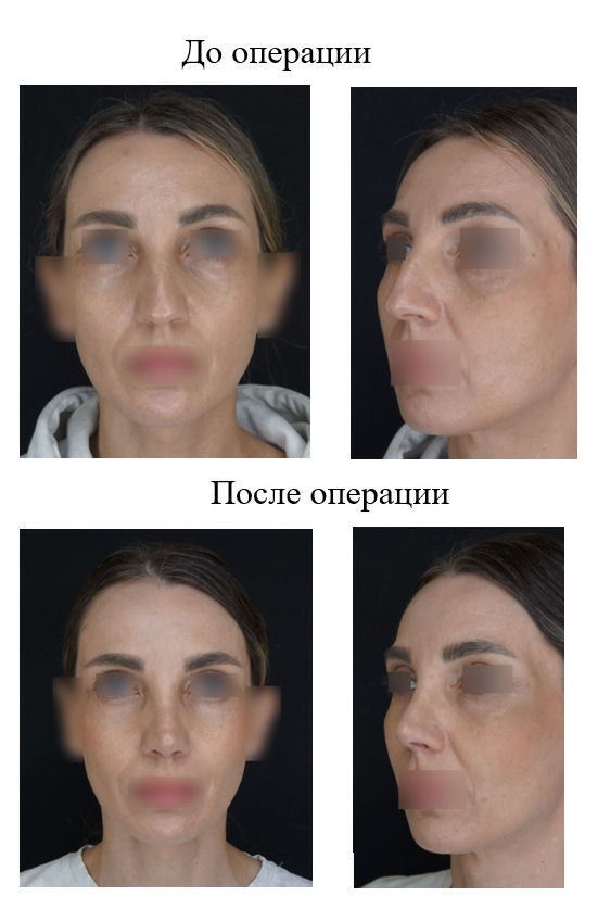 фотография категории