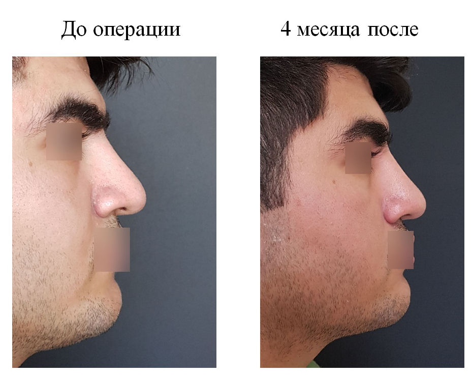 фотография категории
