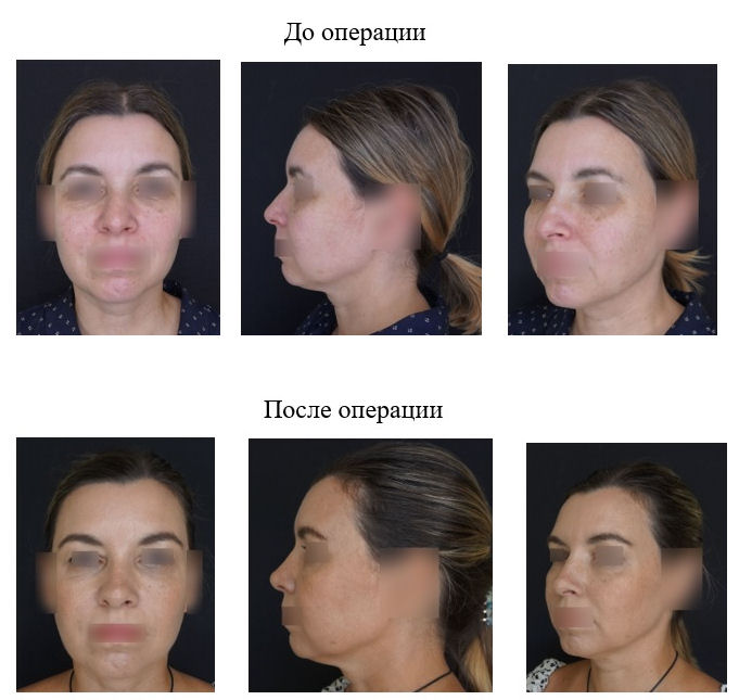 фотография категории