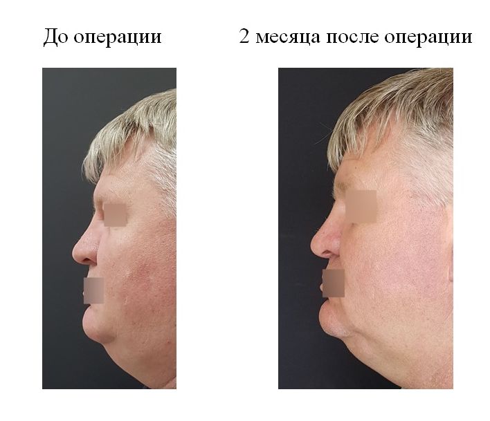 фотография категории