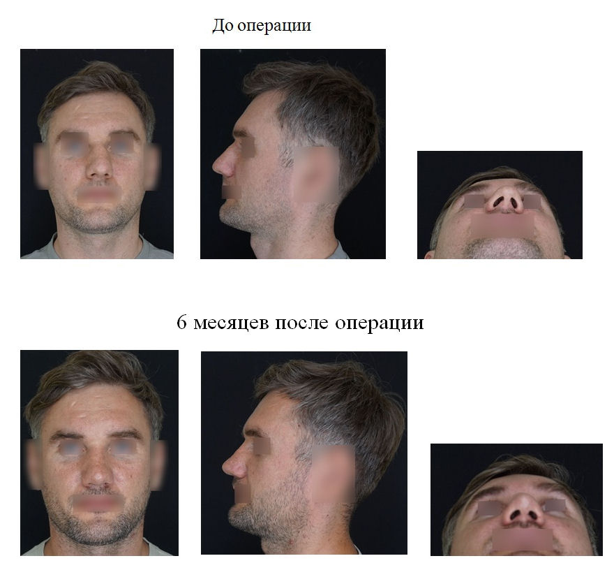 фотография категории