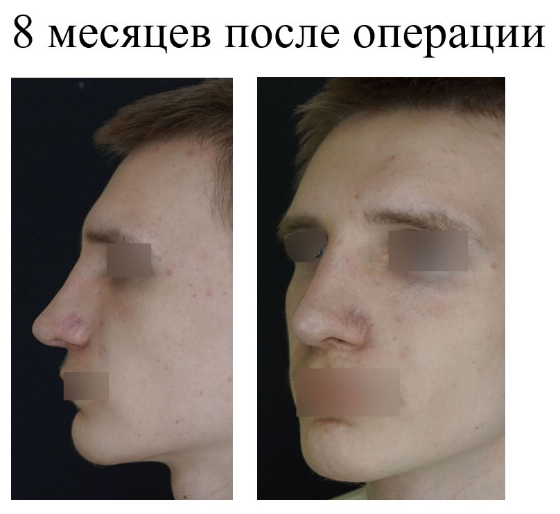 фотография категории