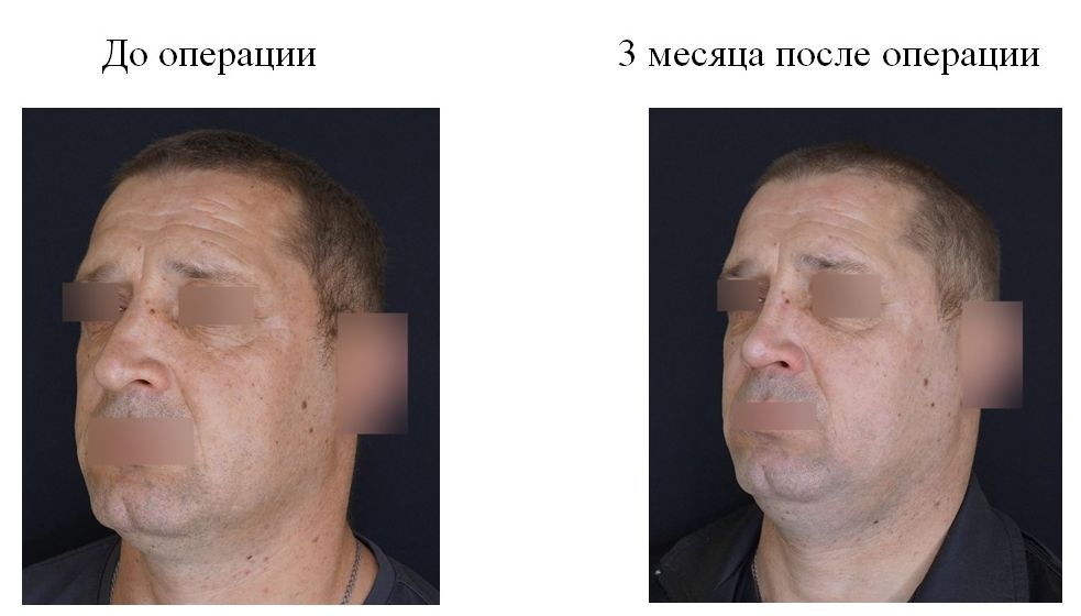 фотография категории