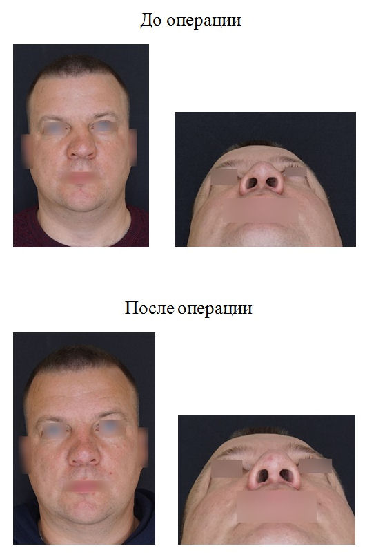 фотография категории