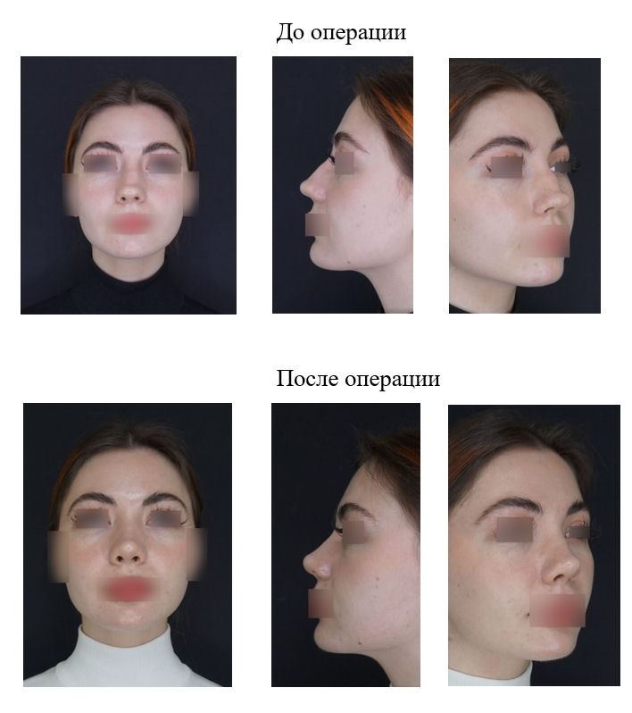 фотография категории